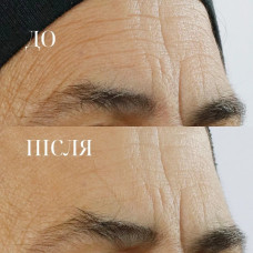 Сироватка із потрійним ретинолом Perricone MD High Potency Triple Retinol Renewal Serum, 59 мл